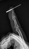 Sewing machine needle