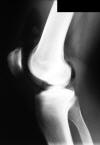 Joint mouse arthrogram 25M