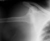 (untitled)