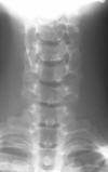 C6 fx C5-6 rotation 25F